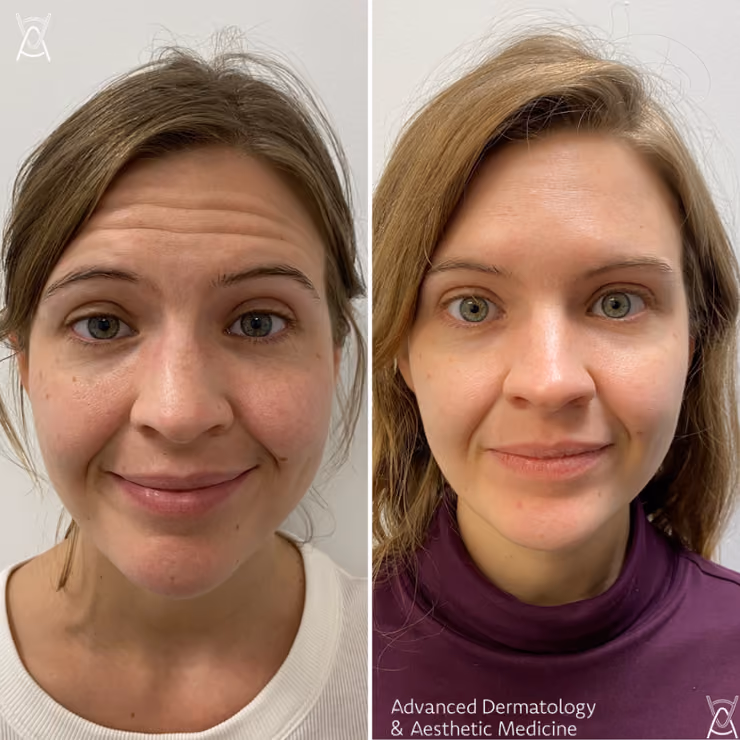 Advanced Dermatology in Chicago: Treatments, Costs, and Choosing a Provider