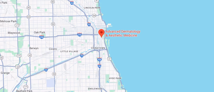 Finding the Best Acne Scar Treatment Near Me: Your Chicago Guide