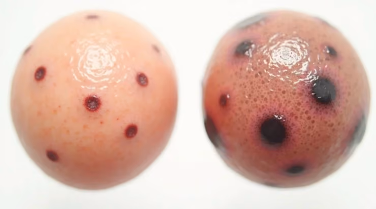 When to Get a Mole Checked: Warning Signs You Shouldn’t Ignore