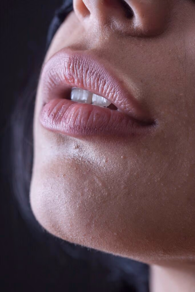 Looking to perfect your pout?