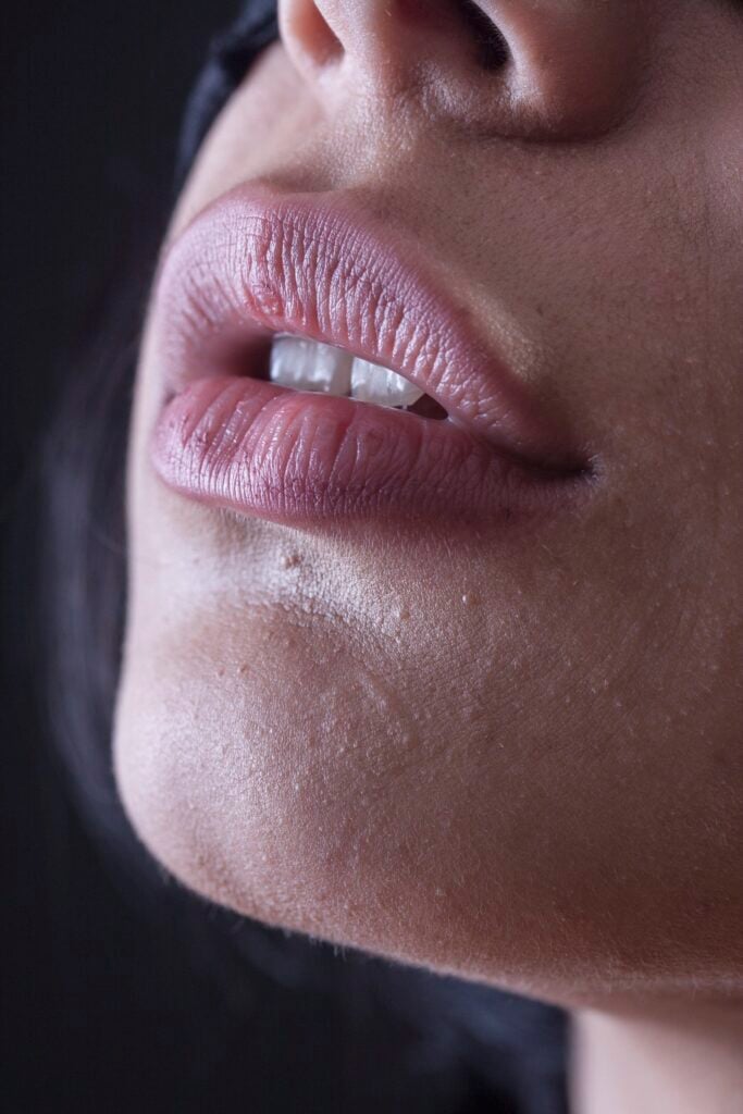 Looking to perfect your pout?