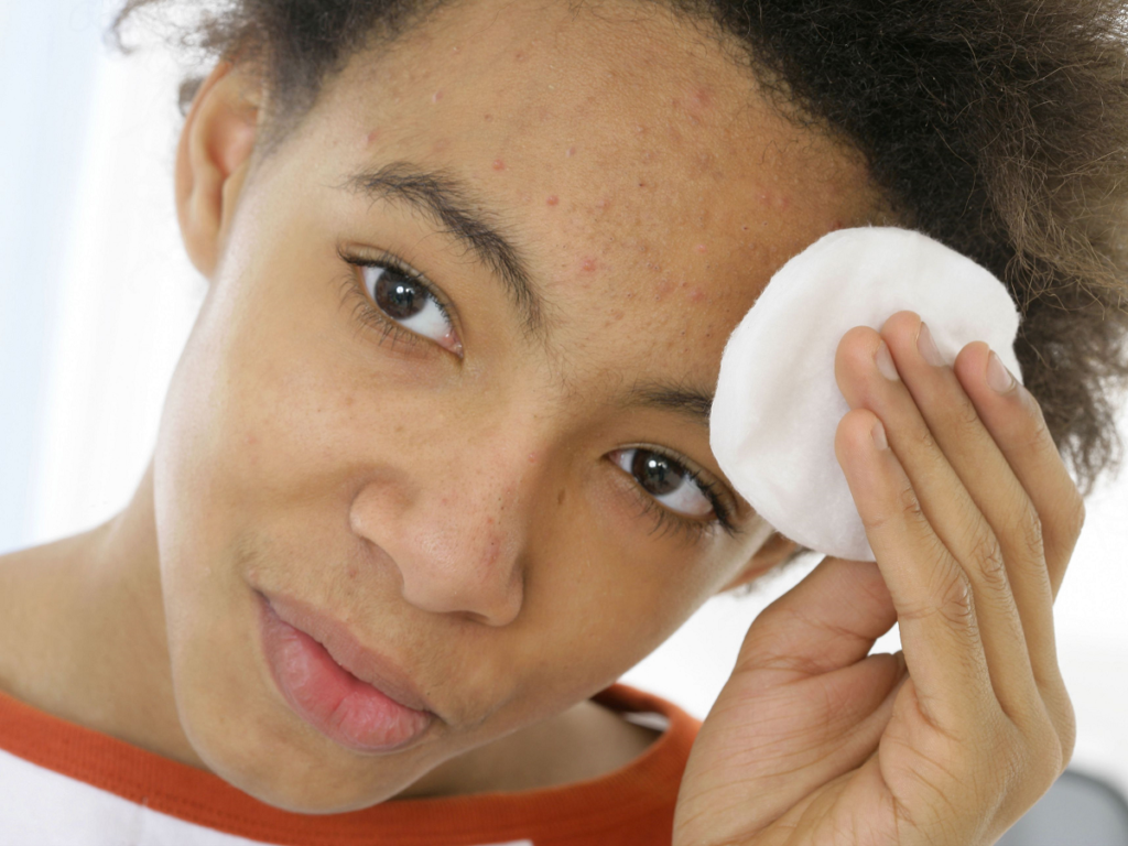 The 411 on Acne: Causes, Treatments and Quick Tips