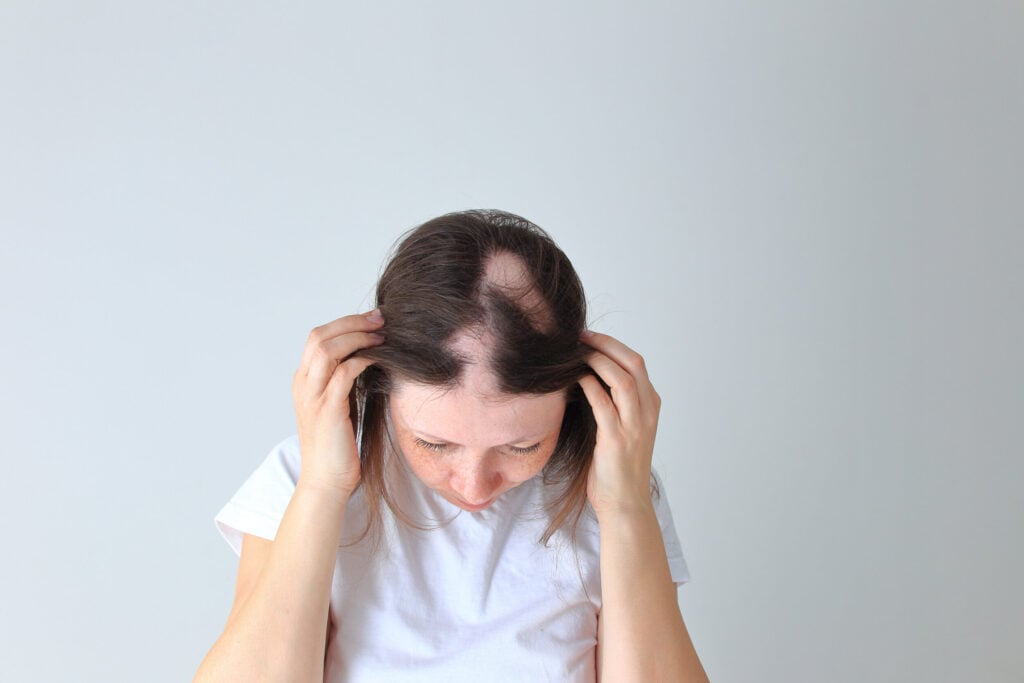 Why Seeing Dermatologists for Hair Loss Is Your Best First Step