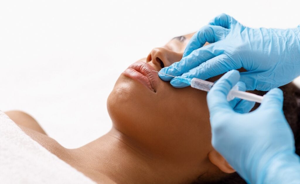 Lip Fillers