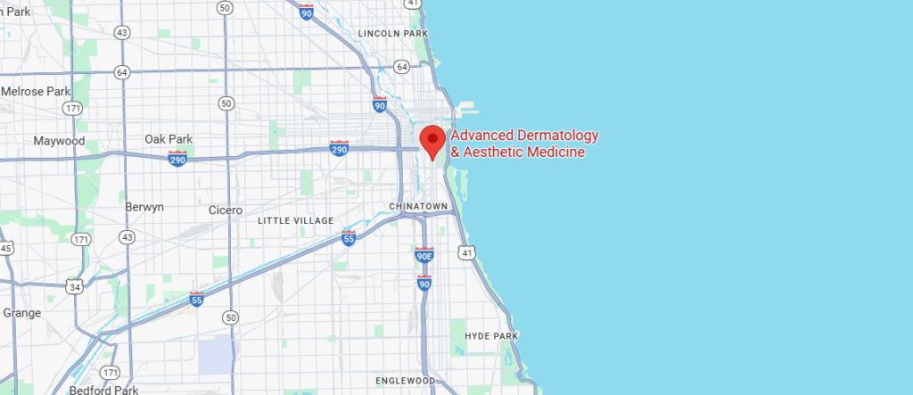Finding the Best Acne Scar Treatment Near Me: Your Chicago Guide