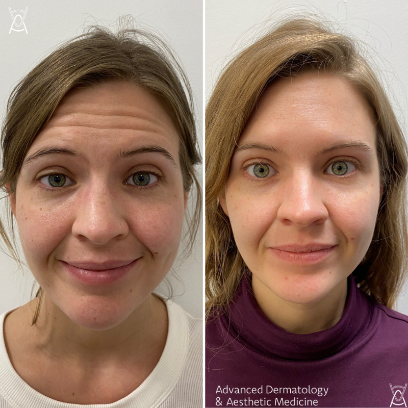 Advanced Dermatology in Chicago: Treatments, Costs, and Choosing a Provider